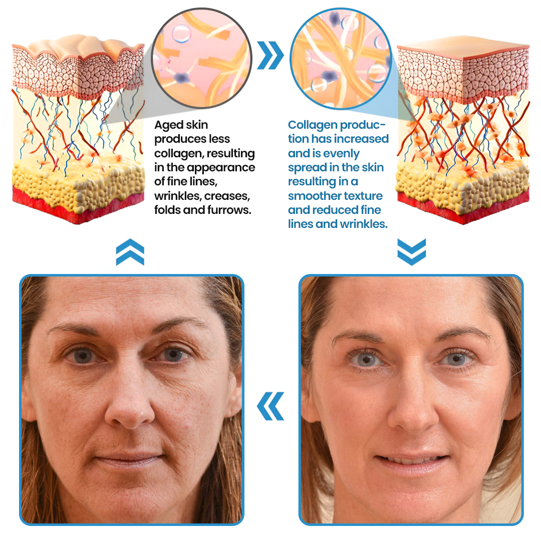 Biancat® Collagen Peptide Serum🇬🇧