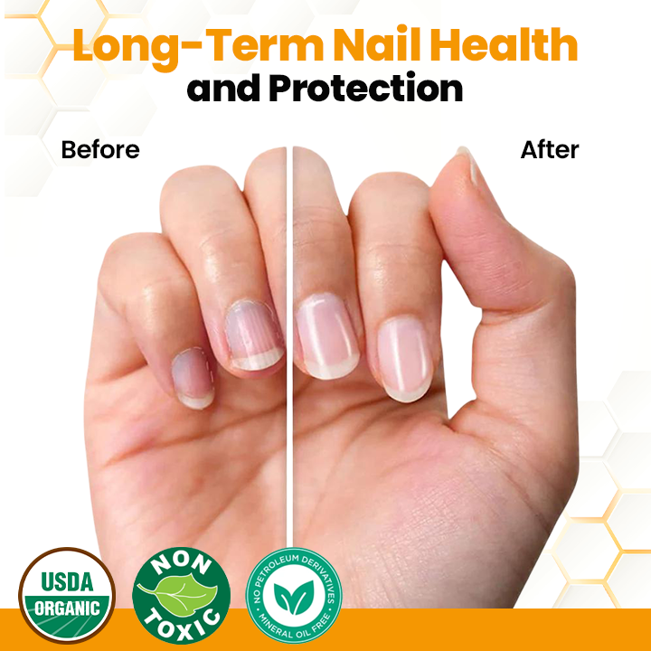 Biancat® BeeVenom Anti-Fungal Nail Renewal Oil 🌟