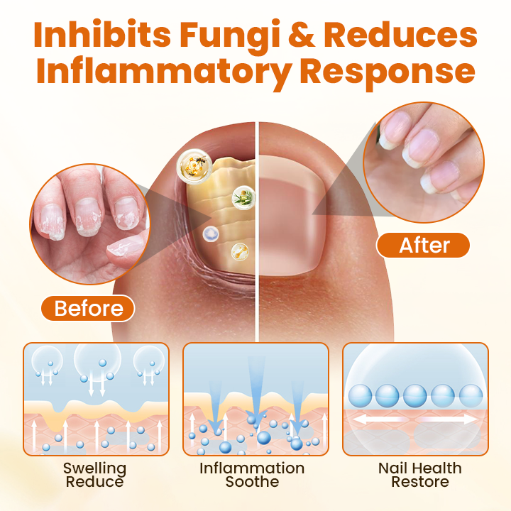 Timilk® FungiBee Advanced Nail Repair Spray⚕️