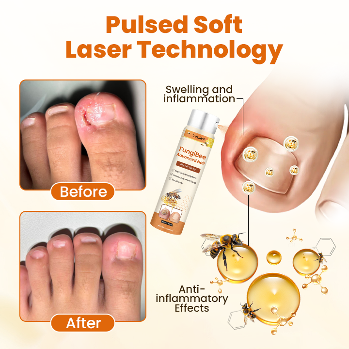 Timilk® FungiBee Advanced Nail Repair Spray⚕️