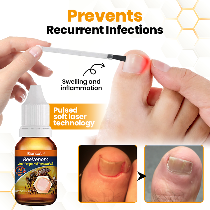 Biancat® BeeVenom Anti-Fungal Nail Renewal Oil 🌟