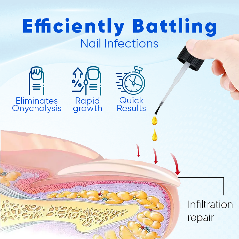 Biancat® OnyxoGuard Nail Growth and Repair Serum 🌟