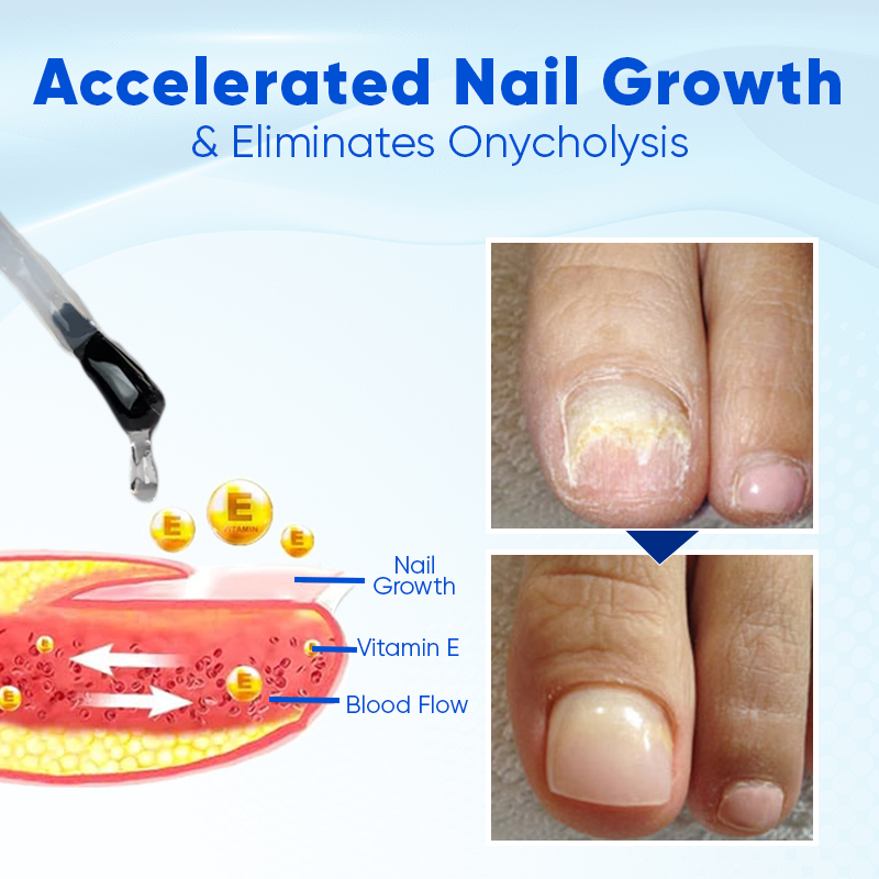 Biancat® OnyxoGuard Nail Growth and Repair Serum 🌟