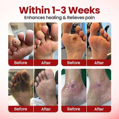 Timilk® VitaGluco Diabetic Care Cream 🇬🇧