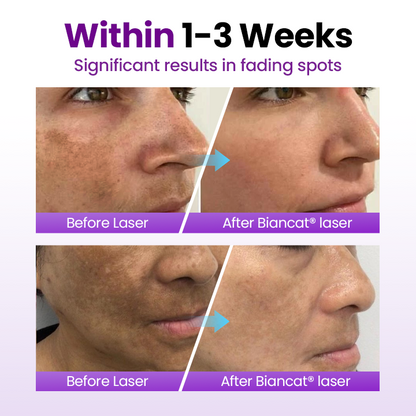 Biancat® SpotErase Probiotic Shield Serum 🇬🇧