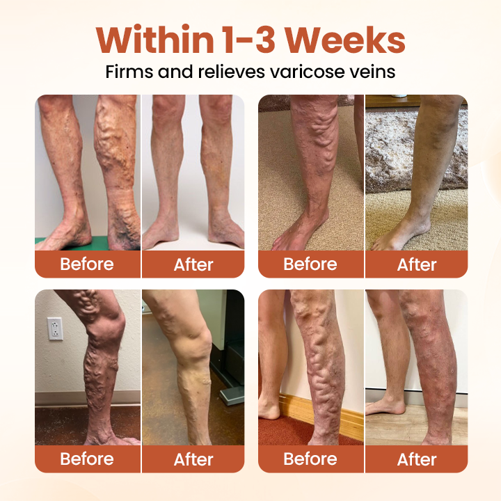 Timilk® VeinTarget Microneedle Patch