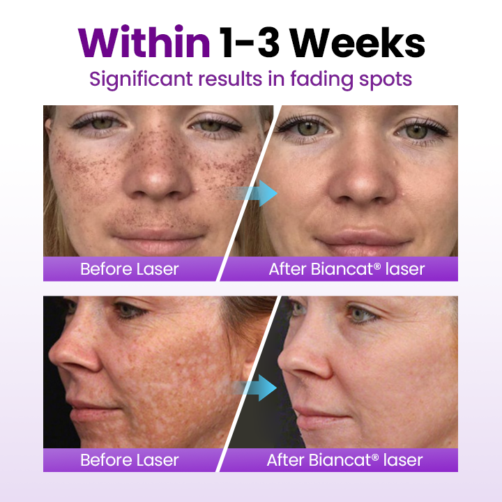 Biancat® SpotErase Probiotic Shield Serum 🇬🇧