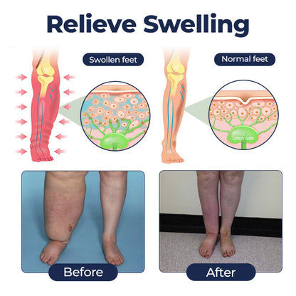 Timilk® SwellRelief Circulation Support Cream