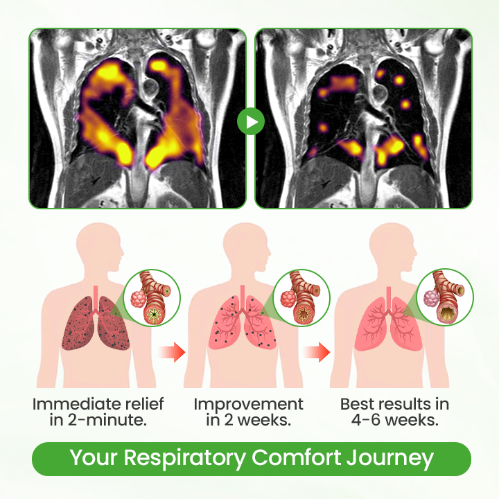 Timilk® HerbaAir Mullein Lung Purifier (new)