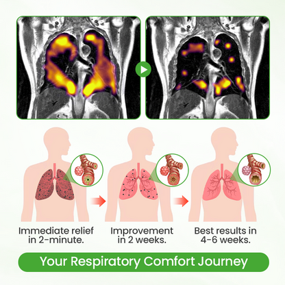 Timilk® HerbaAir Mullein Lung Purifier (new)