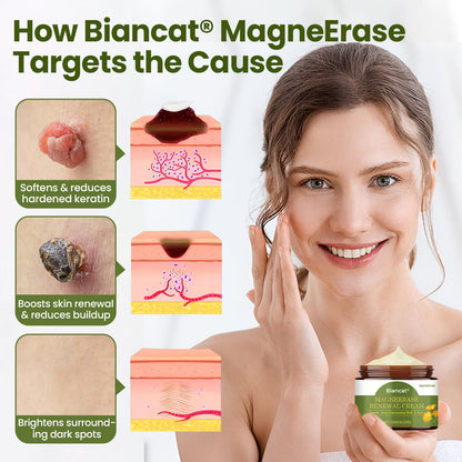 Biancat® MagneErase Renewal Cream 🇬🇧 MagneErase-upsell