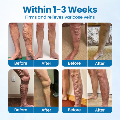 Timilk® VeinGuard Herbal Spray