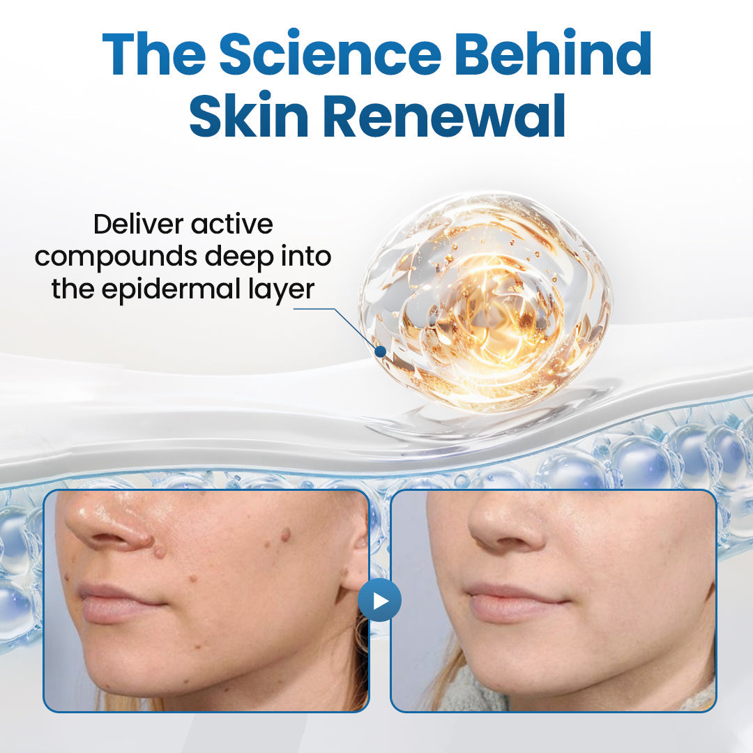 Biancat® BumpFlatten Cream🇬🇧