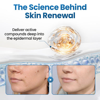 Biancat® BumpFlatten Cream🇬🇧