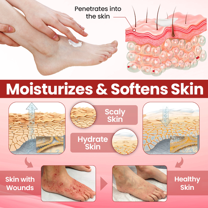 Timilk® VitaGluco Diabetic Care Cream 🇬🇧