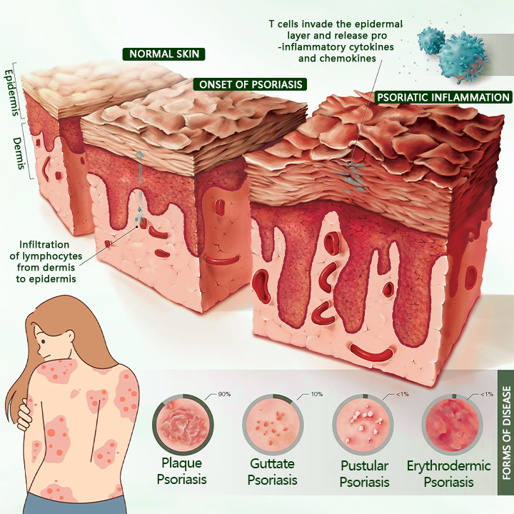 Timilk® DermaPure Tea Tree Healing Cream✨