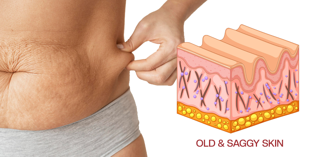 Timilk® AuréLuxe Body Firming Oil 🇬🇧