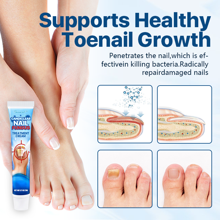 Biancat® Candiclear Nail Fungus Treatment Cream🌟