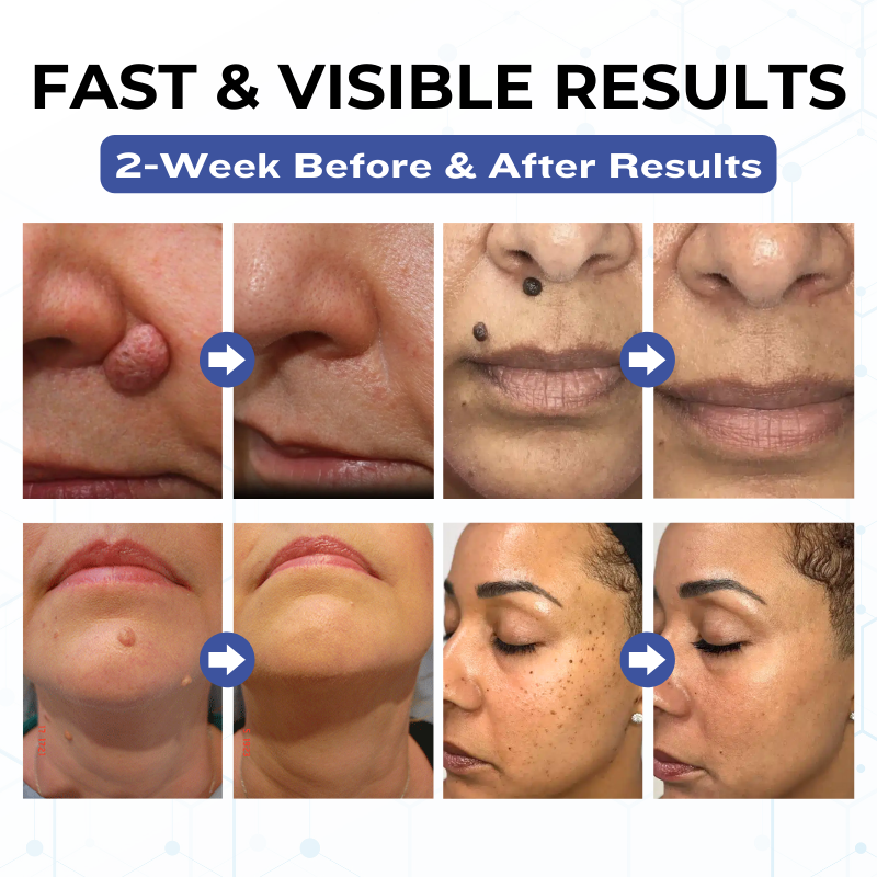 Timilk® VanishPro Skin Spot Removal Cream 🇬🇧