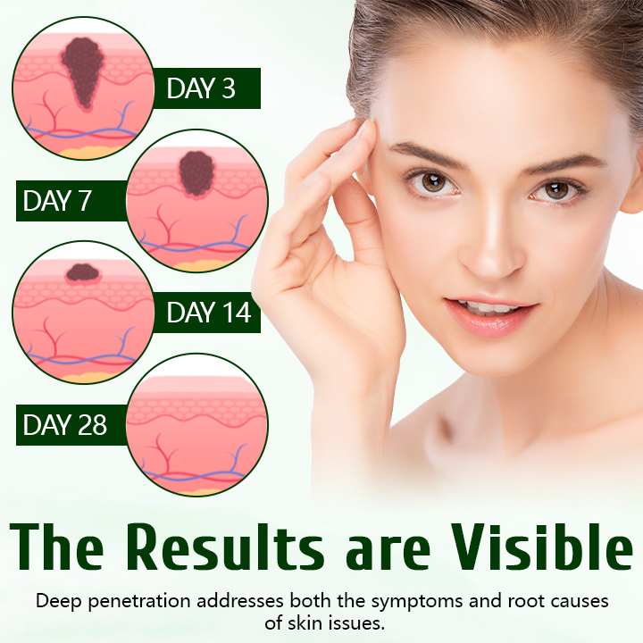 Timilk® DermaPure Tea Tree Healing Cream✨