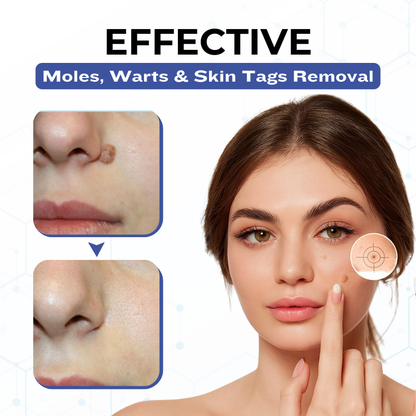 Timilk® VanishPro Skin Spot Removal Cream 🇬🇧