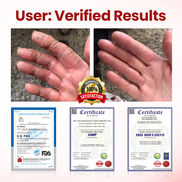 Timilk® VitaGluco Diabetic Care Cream 🇬🇧