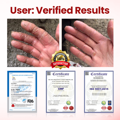 Timilk® VitaGluco Diabetic Care Cream 🇬🇧