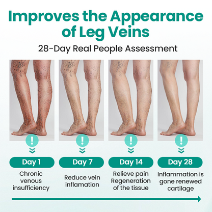 Timilk® LegRenew Varicose Veins Patch