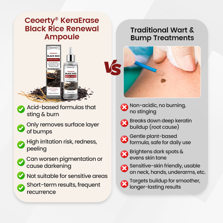 Ceoerty® KeraErase Black Rice Renewal Ampoule 🇬🇧