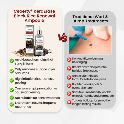 Ceoerty® KeraErase Black Rice Renewal Ampoule 🇬🇧
