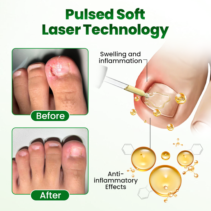 Timilk® HerbaNail 7-Day Repair Serum 🔥 FDA Certified (Clinically Proven Herbal Formula for 7-Day Nail Fungus Repair & Strength Restoration 🌿)