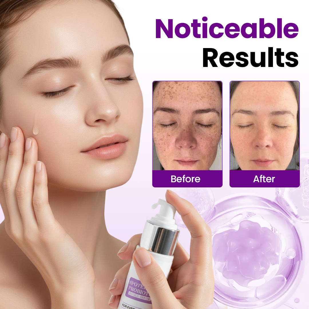 Biancat® SpotErase Probiotic Shield Serum 🇬🇧
