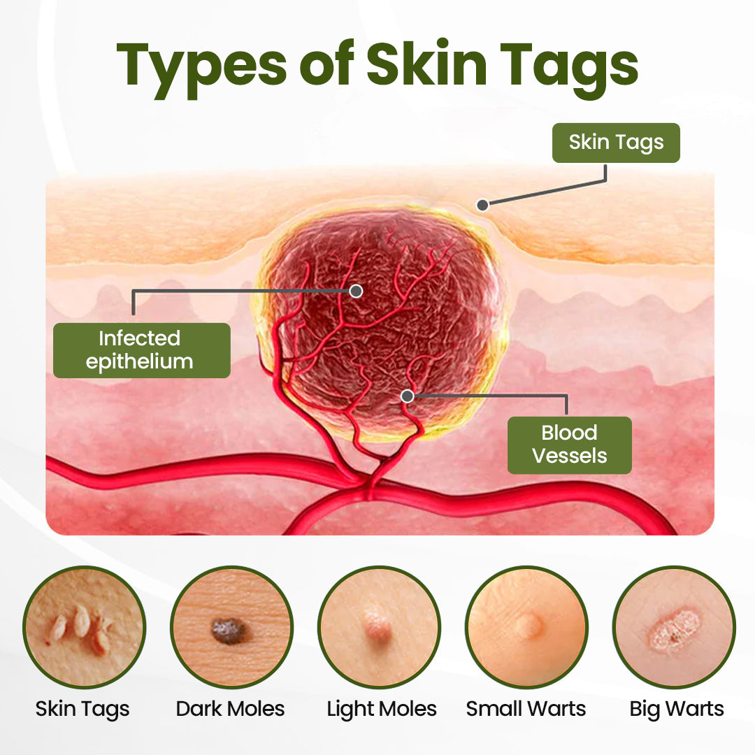 Biancat® MagneErase Renewal Cream 🇬🇧 MagneErase-upsell