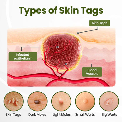 Biancat® MagneErase Renewal Cream 🇬🇧 MagneErase-upsell