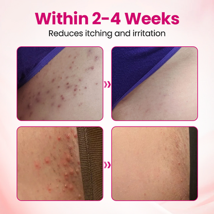 Timilk® IntiDefend Anti-HPV Interferon Gel