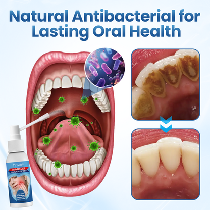 Timilk® GumRelief Natural Spray🔥