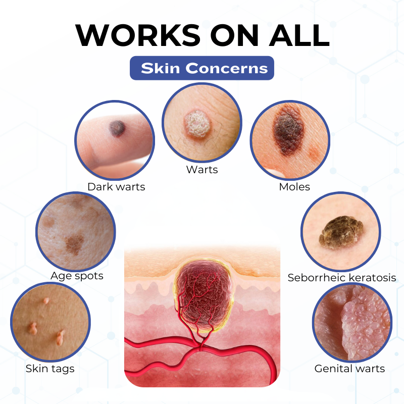 Timilk® VanishPro Skin Spot Removal Cream 🇬🇧