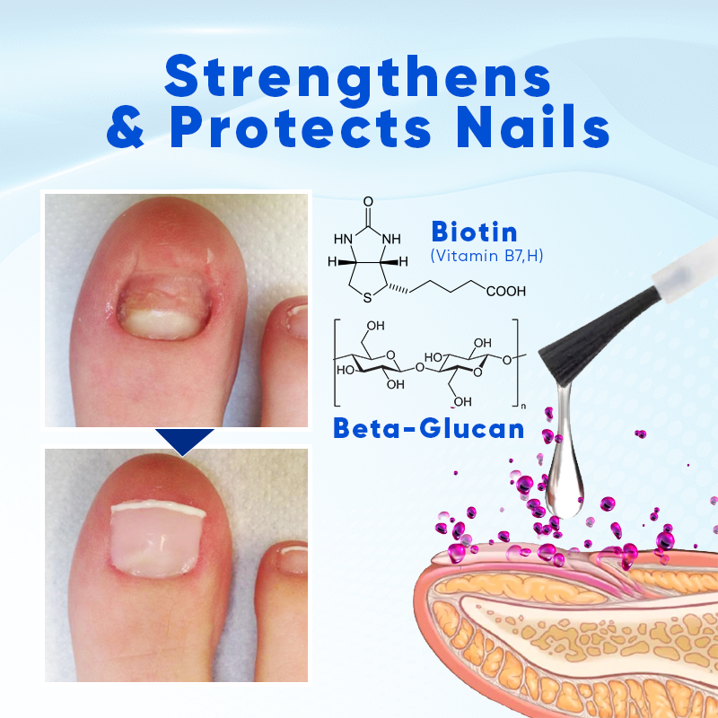 Biancat® OnyxoGuard Nail Growth and Repair Serum 🌟