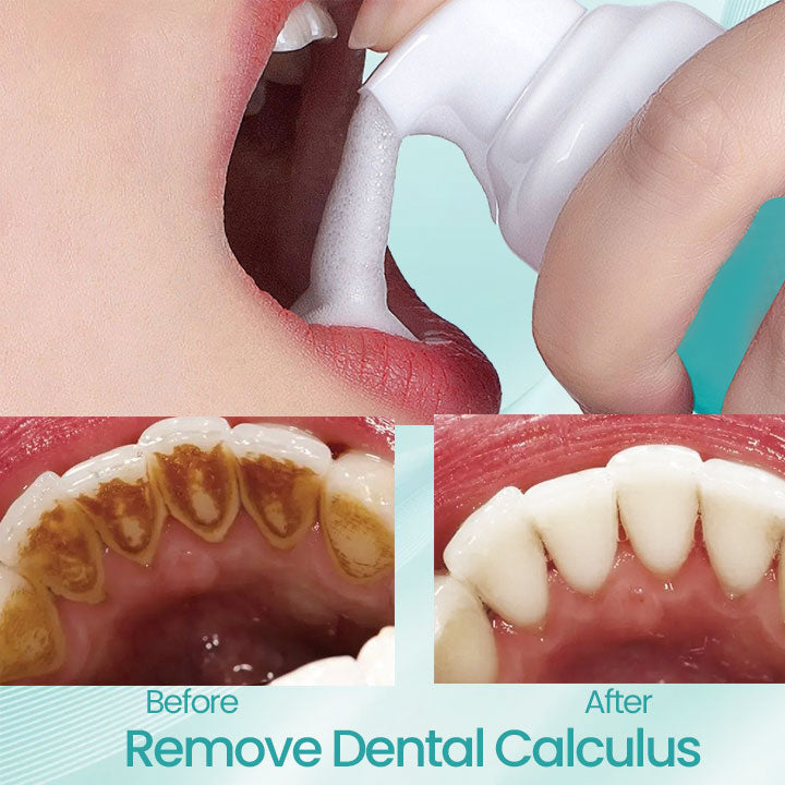 Ceoerty® RadiantSmile Oral Rinse