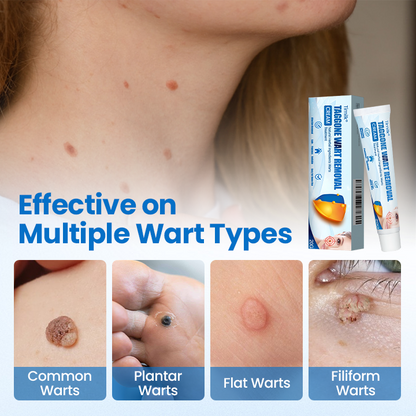 Timilk® TagGone Wart Removal Cream ✨
